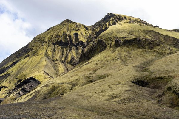 Rhinoplastie saint cyr : transformez votre visage dès maintenant